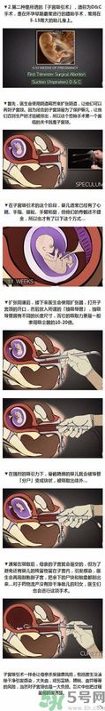 堕胎手术的可怕细节 姑娘们你还堕胎吗?多图