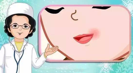 口角炎吃什么好 口角炎不适合吃什么食物