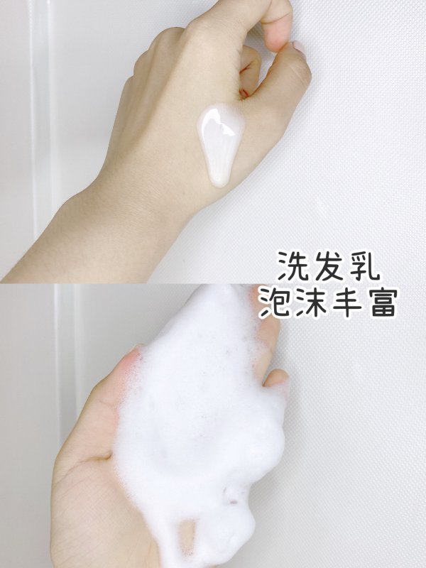 当代秃头女大学生的脱发困扰终于有救啦