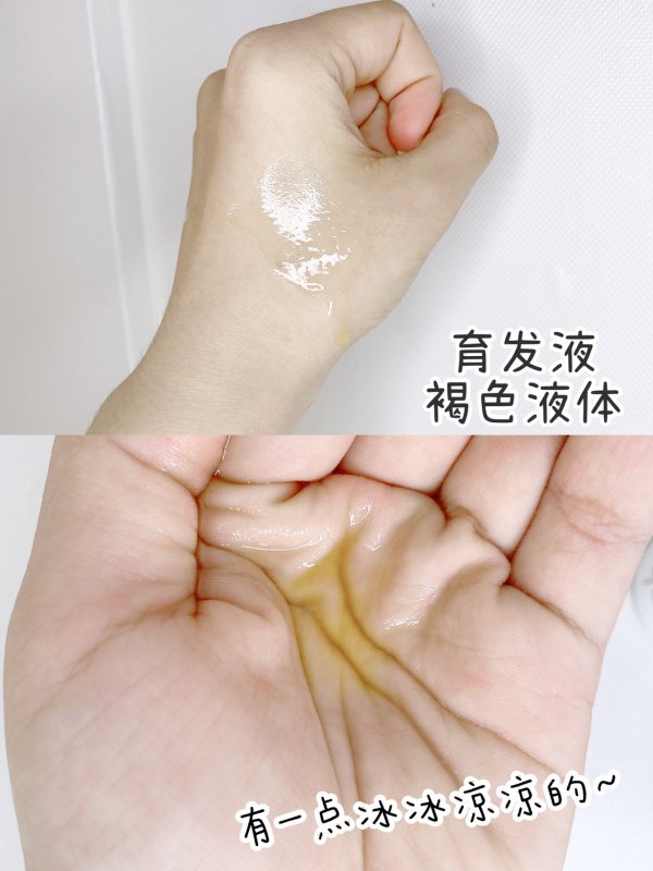 当代秃头女大学生的脱发困扰终于有救啦
