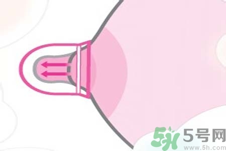 乳头内陷能不能喂奶？乳头凹陷怎样哺乳？