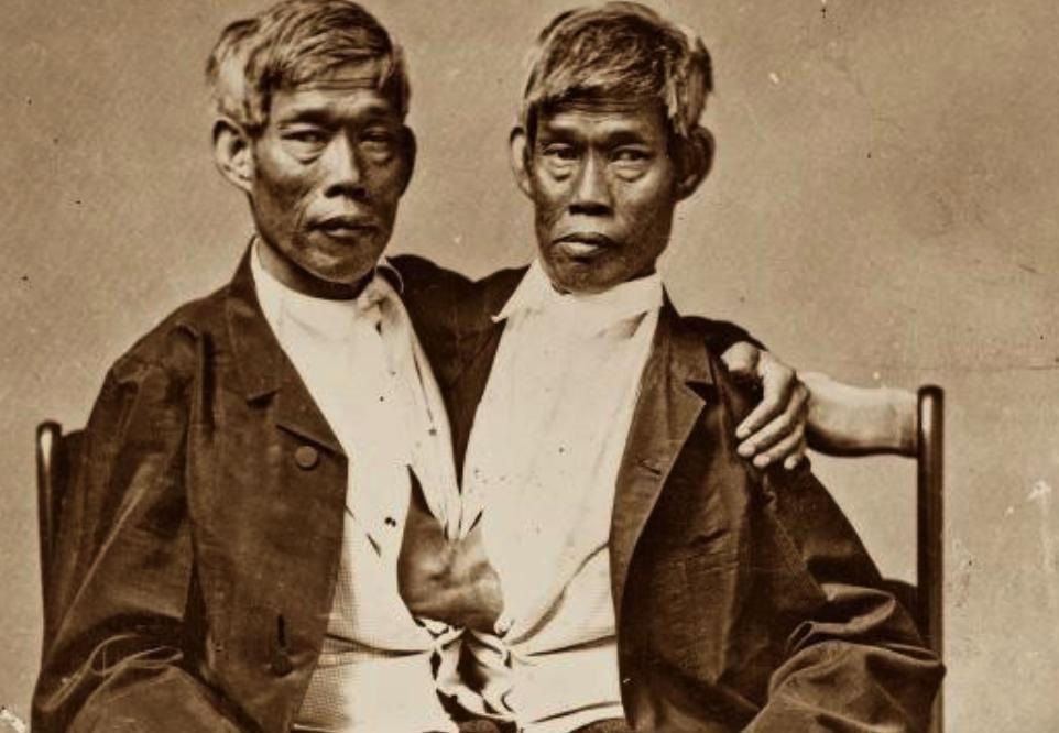 连体人怎么控制身体的，连体人是不是只要一个人吃饭就行？