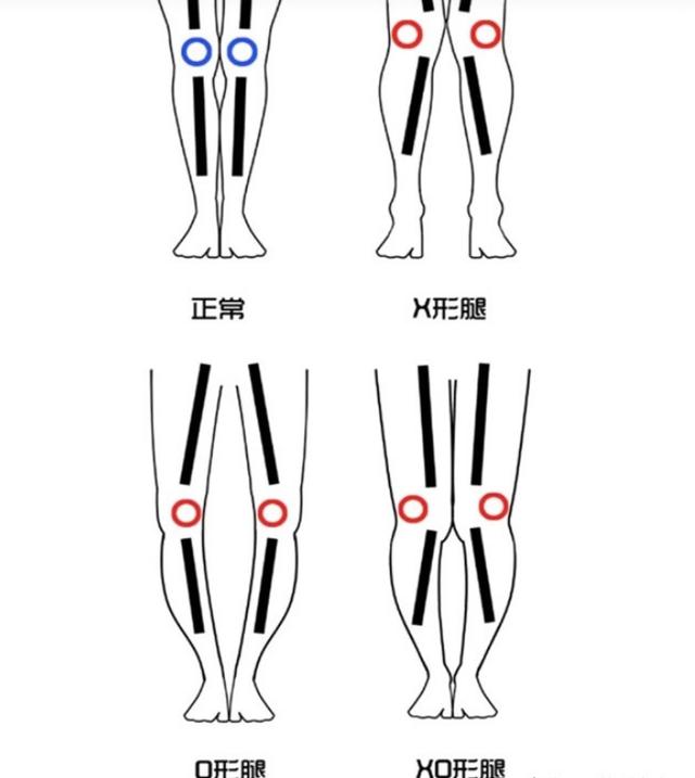 建议“大腿粗”的女生，穿裤子尽量注意这3点