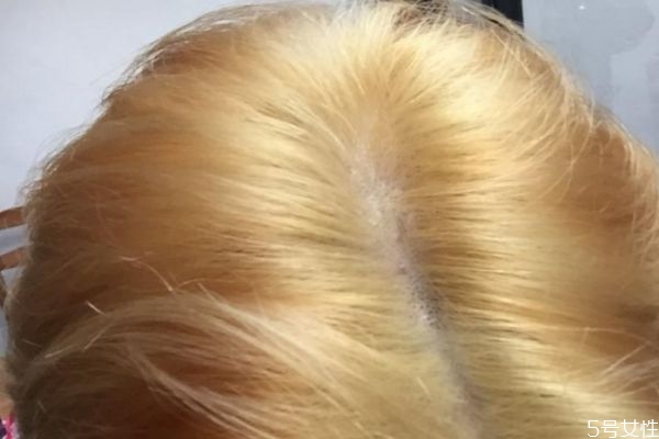 漂发可以连续两次吗 漂发和染发有啥区别