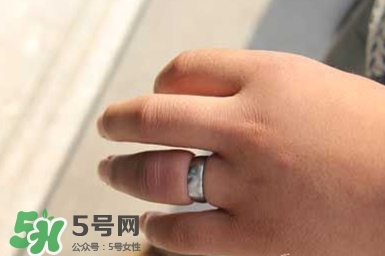 手指被戒指卡住了怎么办?手指被戒指卡住解救法
