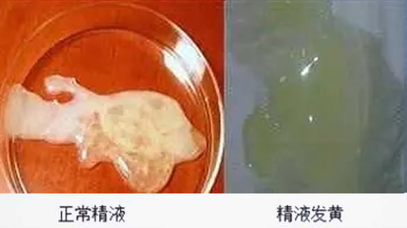 
	死精和活精的区别(附对比图)
