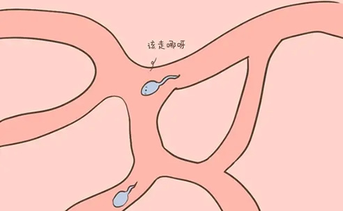 
	备孕夫妻同房后判断精子进入输卵管的方法
