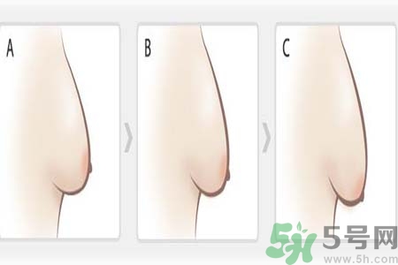 如何预防胸部松弛？吃什么能使胸部挺拔？