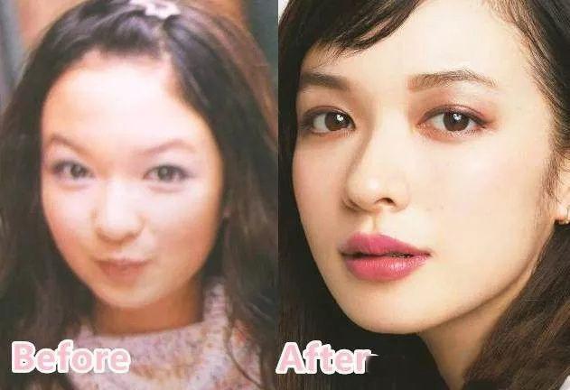 日式整容和韩式整容有什么区别 极致美与自然美