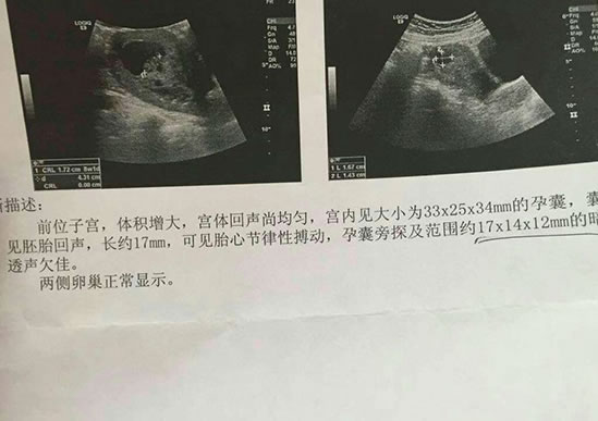 
	孕13周能看出男女吗 准确率高不高
