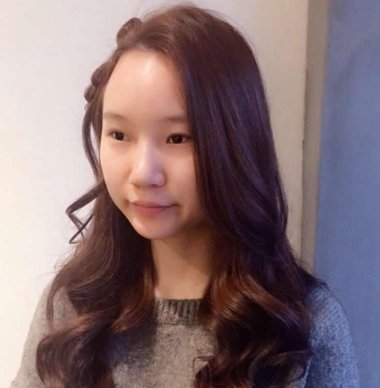 染头发爆顶了怎么办 染头发容易爆顶能不染就别染了