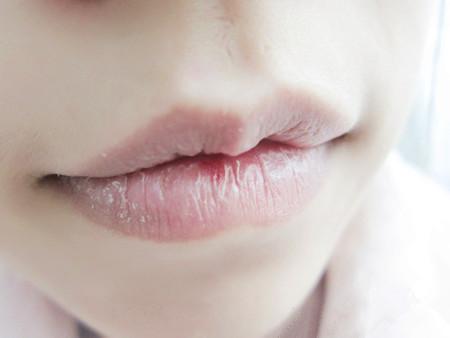 秋冬降温，嘴巴又要脱皮了，唇部敏感的人该怎么养护呢？
