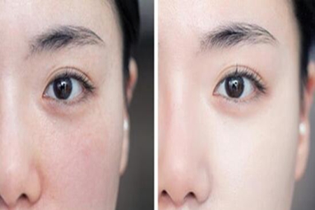 脸上卡粉是什么原因？如何避免出现卡粉情况