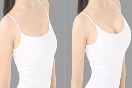 女性丰胸的最快方法，夏季养生小知识了解