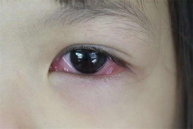 三岁孩子老是眨眼是怎么回事 