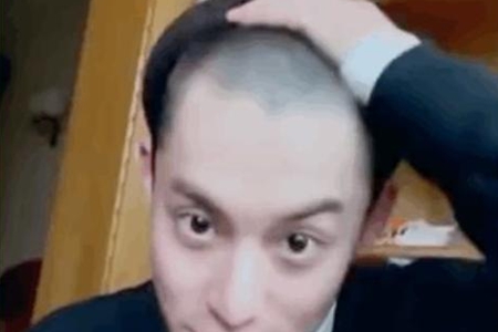 王鹤棣剃光头露出美人尖，网友：果然长得帅就是任性