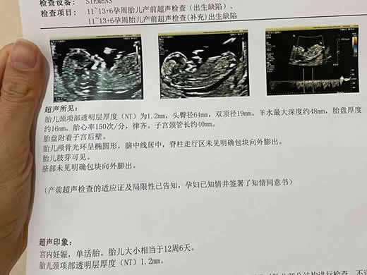 
	呈握拳状一般都是男孩吗 四维单子胎儿生长指标
