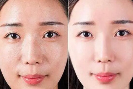 脸上出油太多怎么解决？这四个方法教你控油清爽一整天