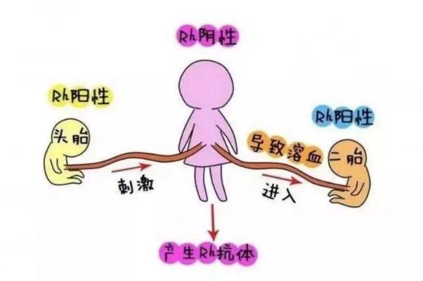 新生儿溶血性疾病 新生儿溶血是什么意思