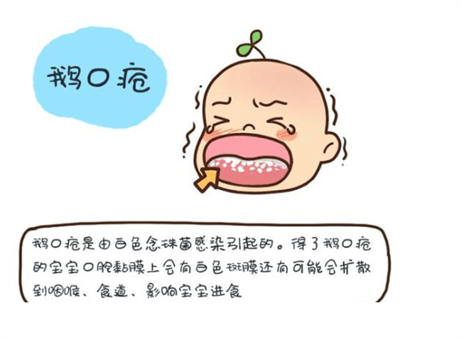 什么是新生儿鹅口疮 