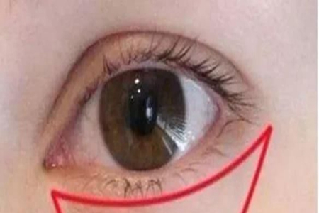 眼部肌肤的常见问题有哪些？不同年龄段如何选择眼霜