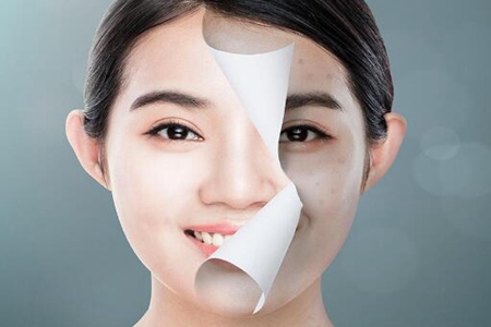 晒黑了怎么快速变白？这四个夏季晒黑快速修复美白方法
