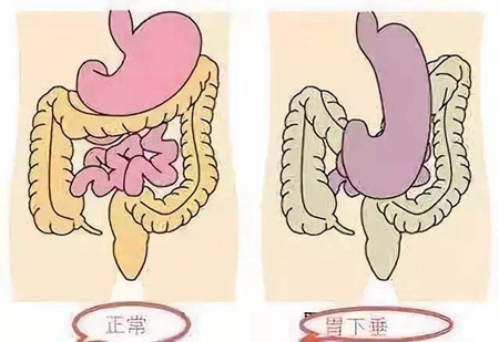 肠胃不好怎么调理,这四种养生技巧远离疾病