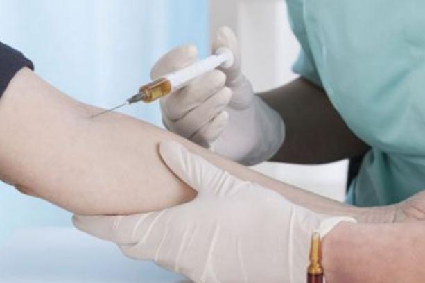 乙肝疫苗需要先检查吗 乙肝疫苗需要补打吗