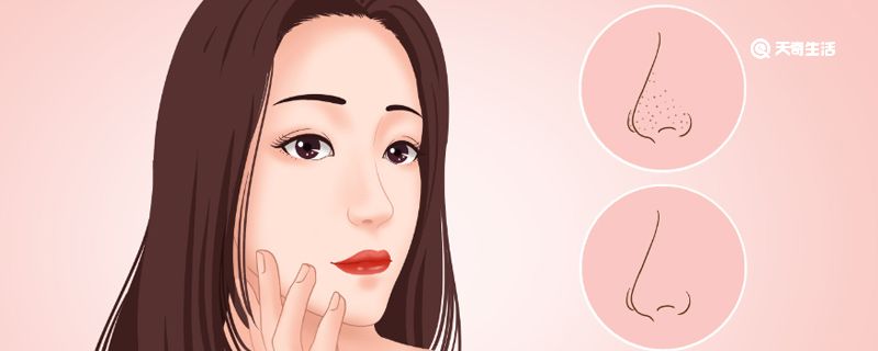 如何去黑头 学生如何去黑头粉刺 