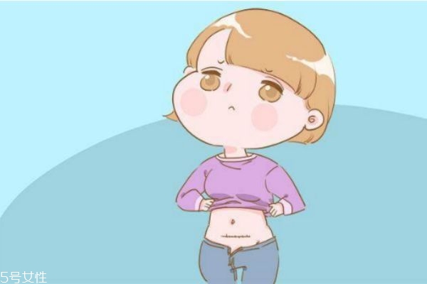 剖腹产后刀口有线头怎么办 剖腹产后有线头如何处理