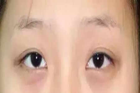 皮肤衰老有什么表现？出现这几个症状说明你的肌肤状态在走下坡路
