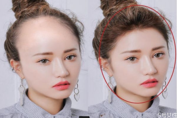 发际线后移是为什么 发际线不好看该怎么修饰
