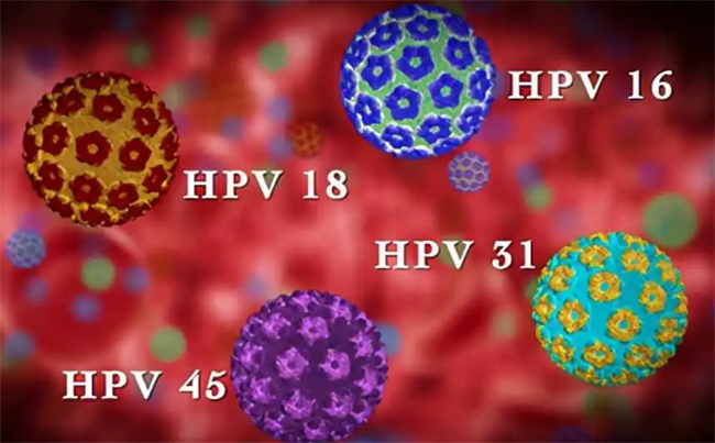 HPV感染后一定要谨记这几点能转阴，HPV感染途径有哪些 