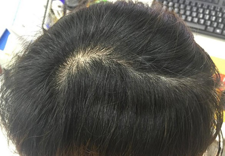想要吸引异性目光从头皮保养开始
