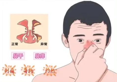 冬季干燥流鼻血怎么办 如何治疗和预防 